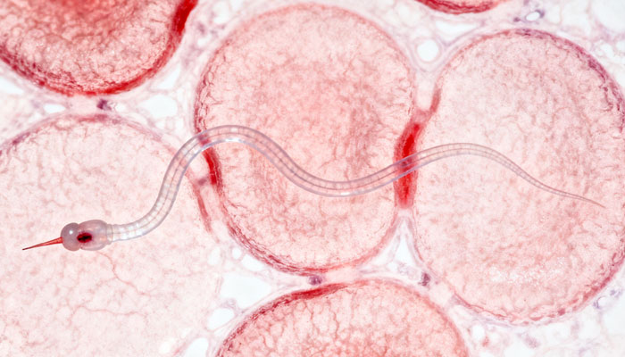 Heartworm